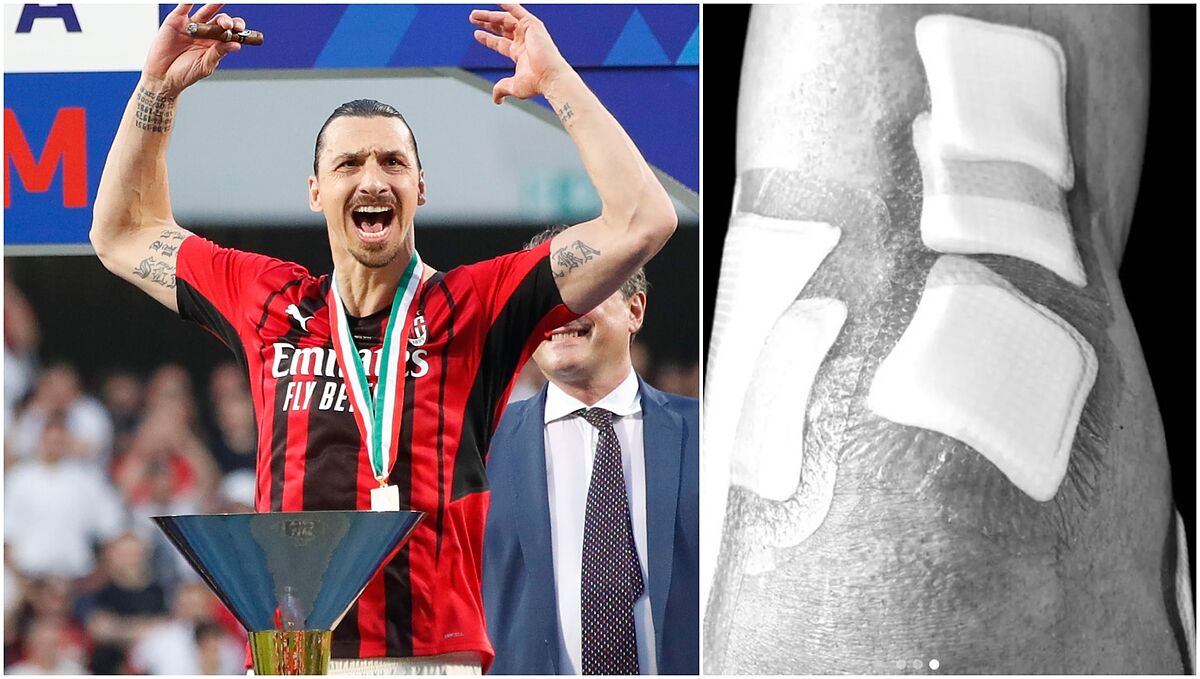 Serie A: Ibrahimovic racconta il calvario al ginocchio: “Non ho mai sofferto così tanto”