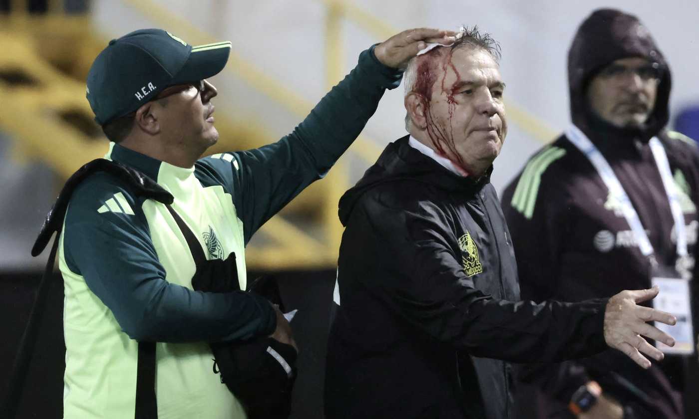 Honduras-Messico: il tecnico ospite Aguirre colpito da una lattina lanciata dagli spalti, sanguina dalla testa|Estero