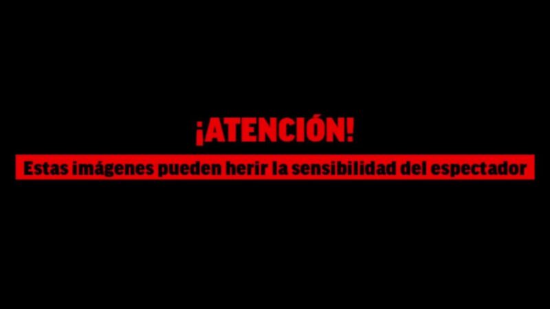 Edoardo Bove è cosciente, sveglio ed estubato