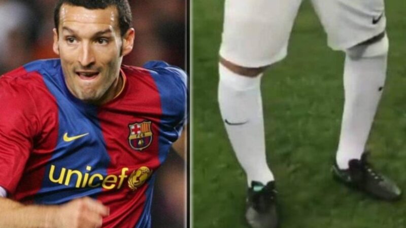 “Li raddrizzeranno tagliando pezzi di osso”