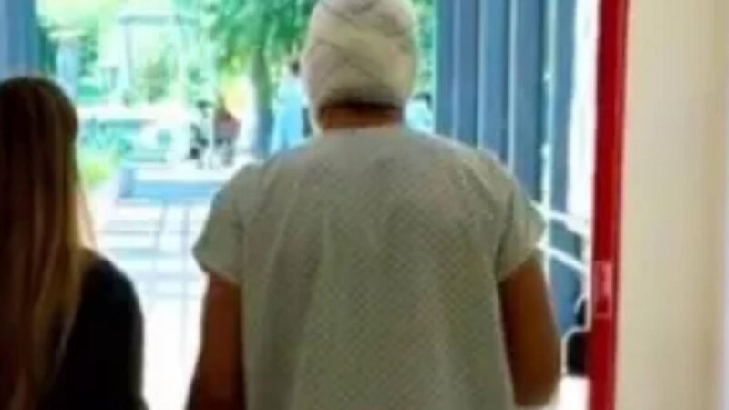 Lúcio mostra per la prima volta lo stato del suo viso dopo il 18% del corpo con un camino