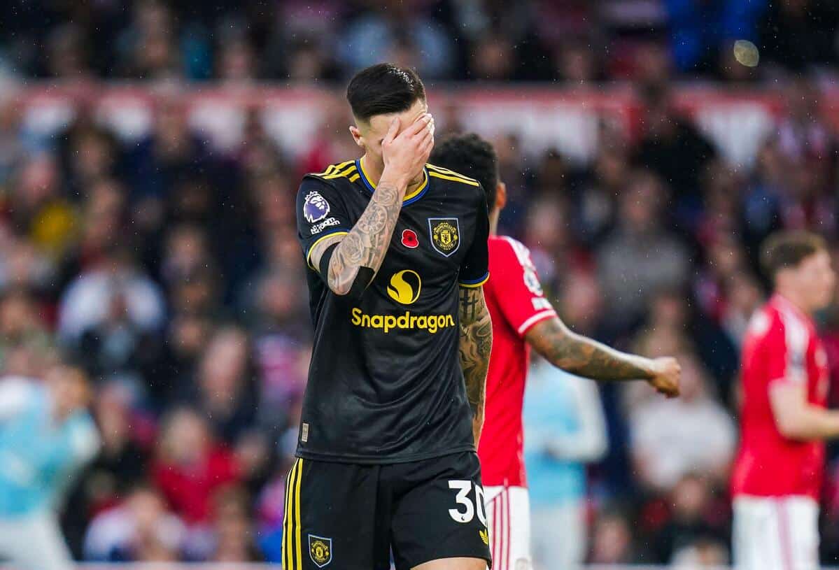 L’infortunio dell’attaccante del Man Utd Sesko “non è così grave”